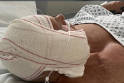 Kiko Matamoros ha compartido una imagen suya recién operado o, como diría él, "rebanado".
