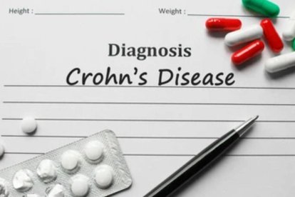 Enfermedad de Crohn