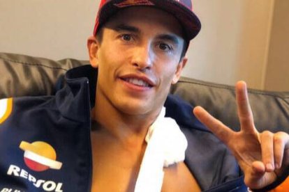 Marc Márquez, con su brazo lesionado.