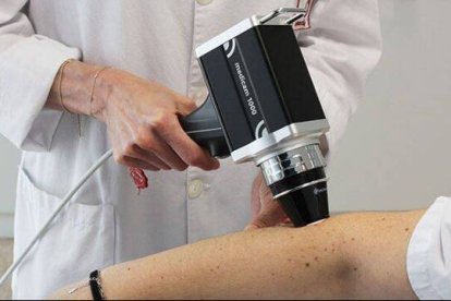 El servicio de Dermatología del Hospital del Vinalopó experimenta un gran avance en la detección precoz del cáncer de piel