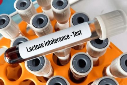 Test de intolerancia a la lactosa