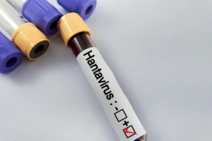 Hantavirus