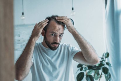 Alopecia