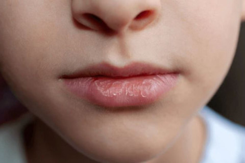 Labios secos