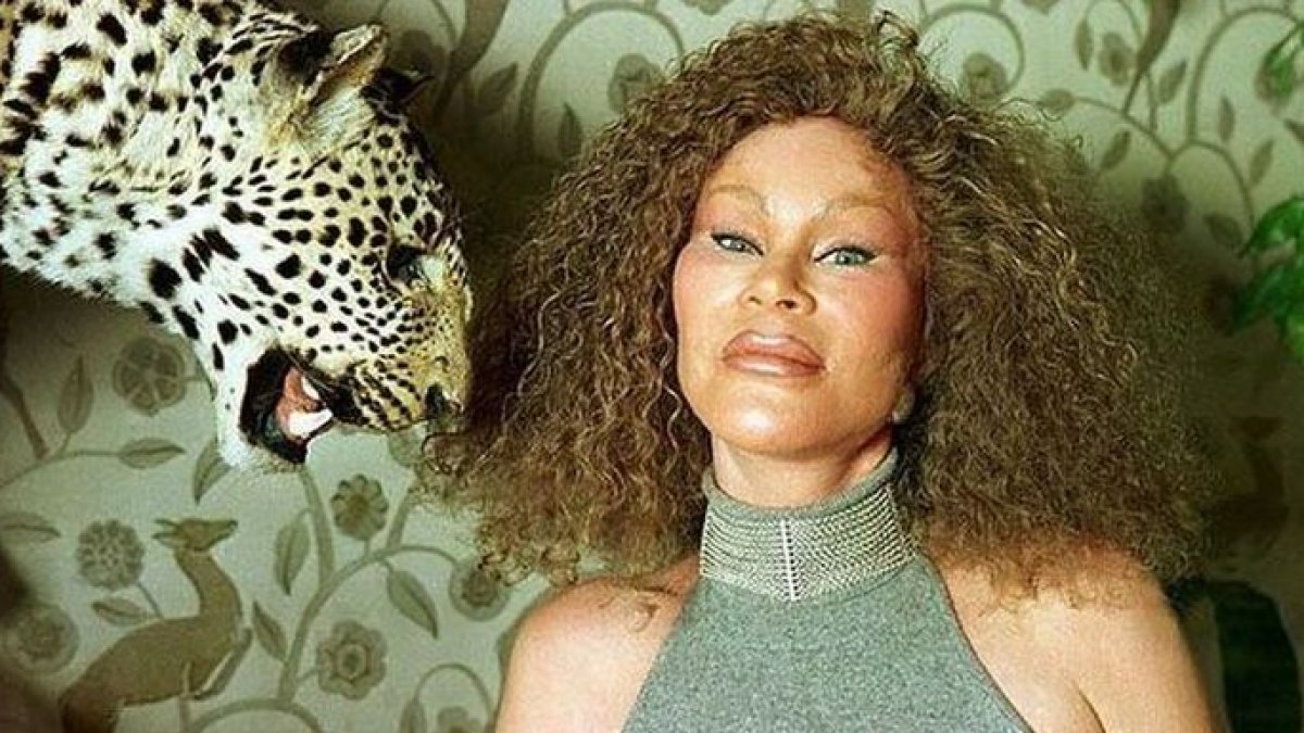 El exceso de Jocelyn Wildenstein