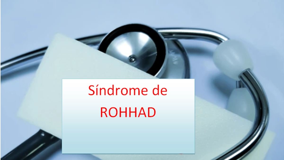 Síndrome de ROHHAD