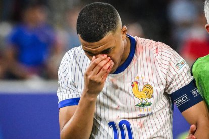 Mbappé se rompió ante Austria el tabique nasal