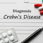 Enfermedad de Crohn