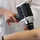 El servicio de Dermatología del Hospital del Vinalopó experimenta un gran avance en la detección precoz del cáncer de piel