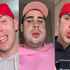 El influencer Jorge Cyrus en su antes (i), durante (c) y después (d) de su operación facial