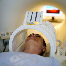 Un avance esperanzador para minimizar los efectos de la radioterapia
