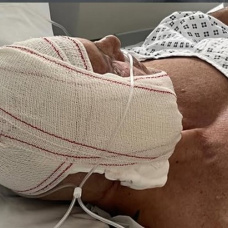 Kiko Matamoros ha compartido una imagen suya recién operado o, como diría él, "rebanado".