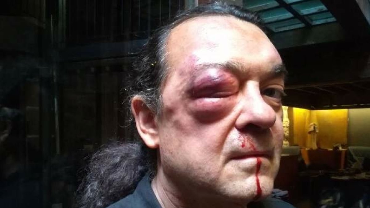 El dirigente crítico de Podemos brutamente agredido, Fernando Barredo.