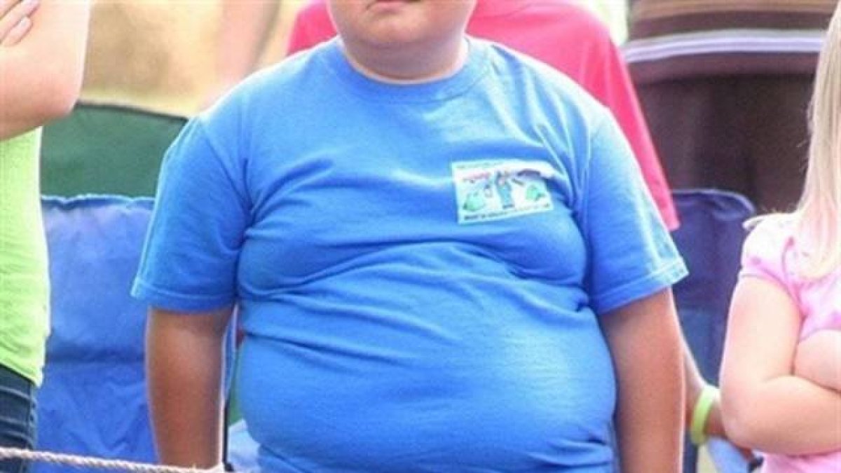 Sanitat monta un escándalo al negar la incineración a los obesos
