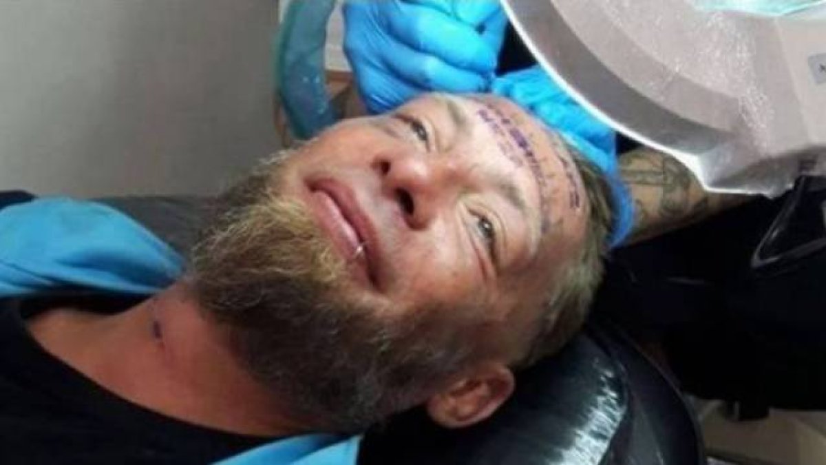 Ofrecieron unas 90 libras por dejarse tatuar en el rostro