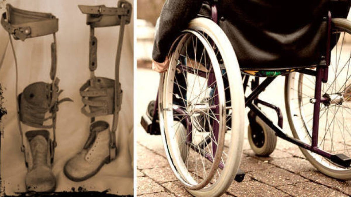 Síndrome PostPolio
