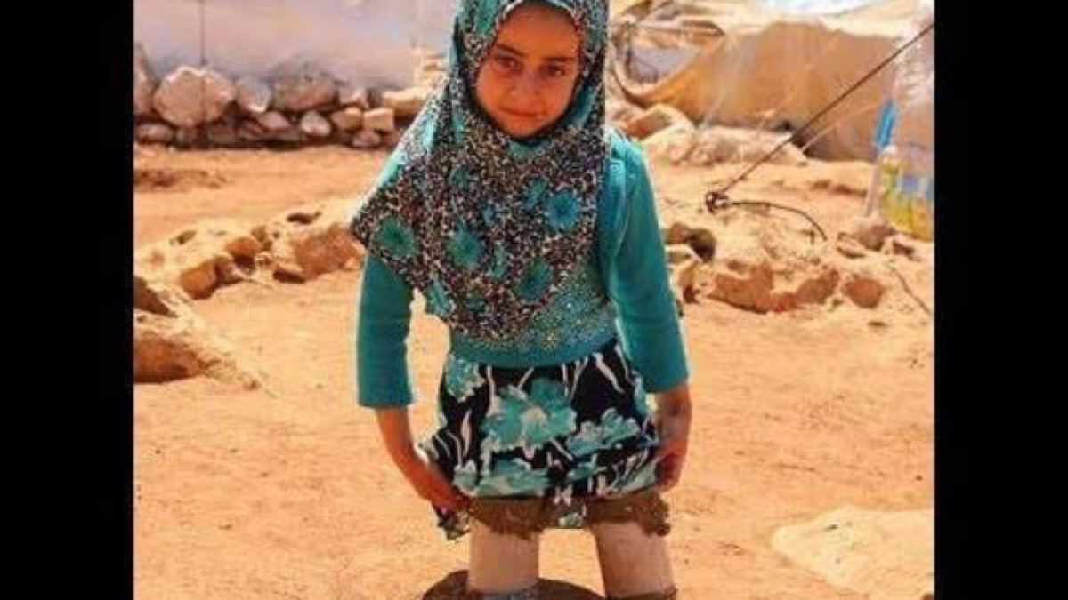 La niña de las piernas de lata