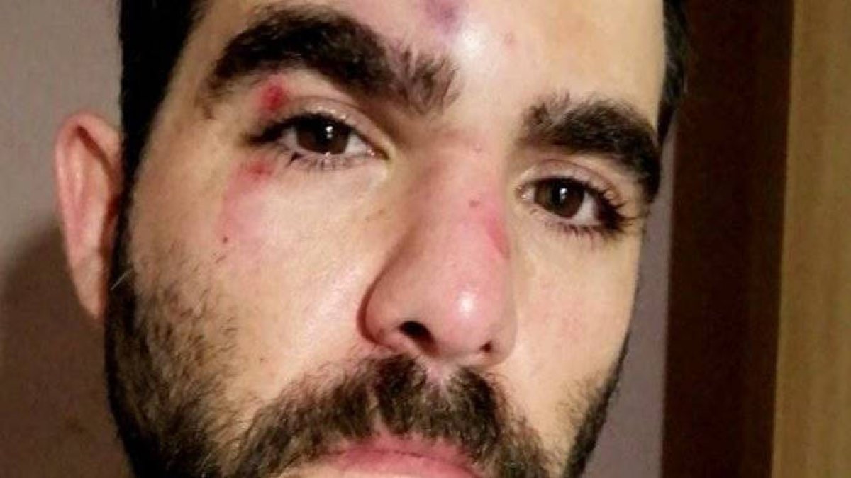 Un periodista de Onda Cero recibe una brutal paliza en plena calle en Barcelona