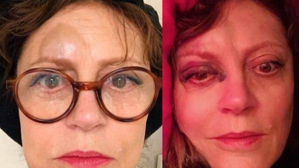 Susan Sarandon se destroza la cara después de sufrir un accidente doméstico