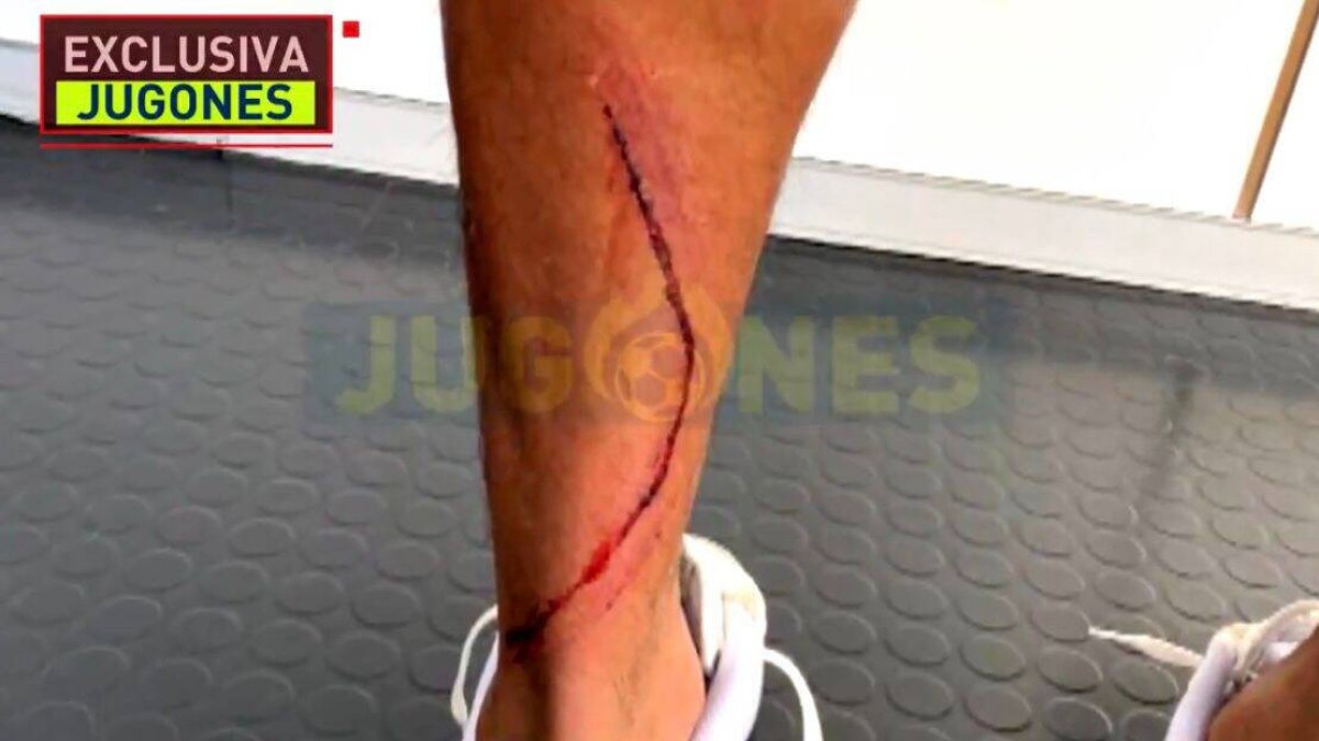 Imagen terrible: Así le dejó la pierna Machís a Marvin tras su dura entrada