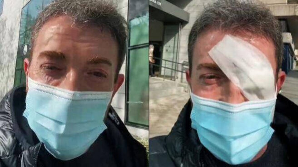 El antes y el después de Motos tras pasar por el quirófano