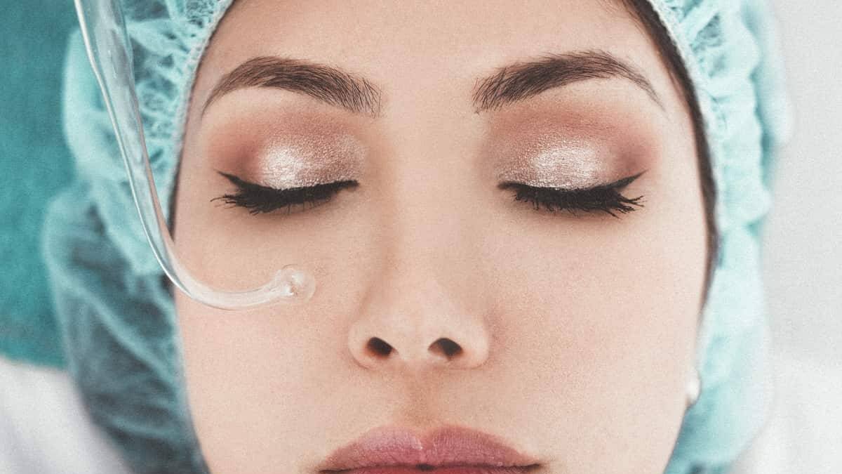 ¿Qué es el Microneedling? Consigue una piel de porcelana y sin imperfecciones