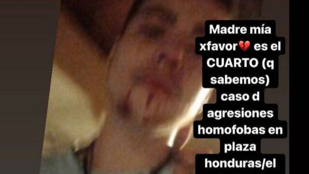 Imagen del joven que sufrió la agresión compartida en sus redes sociales