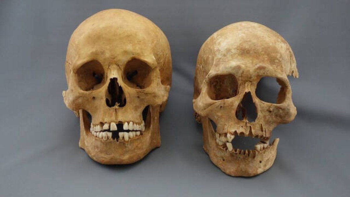 Foto de archivo: Dos cráneos de dos víctimas de la peste.