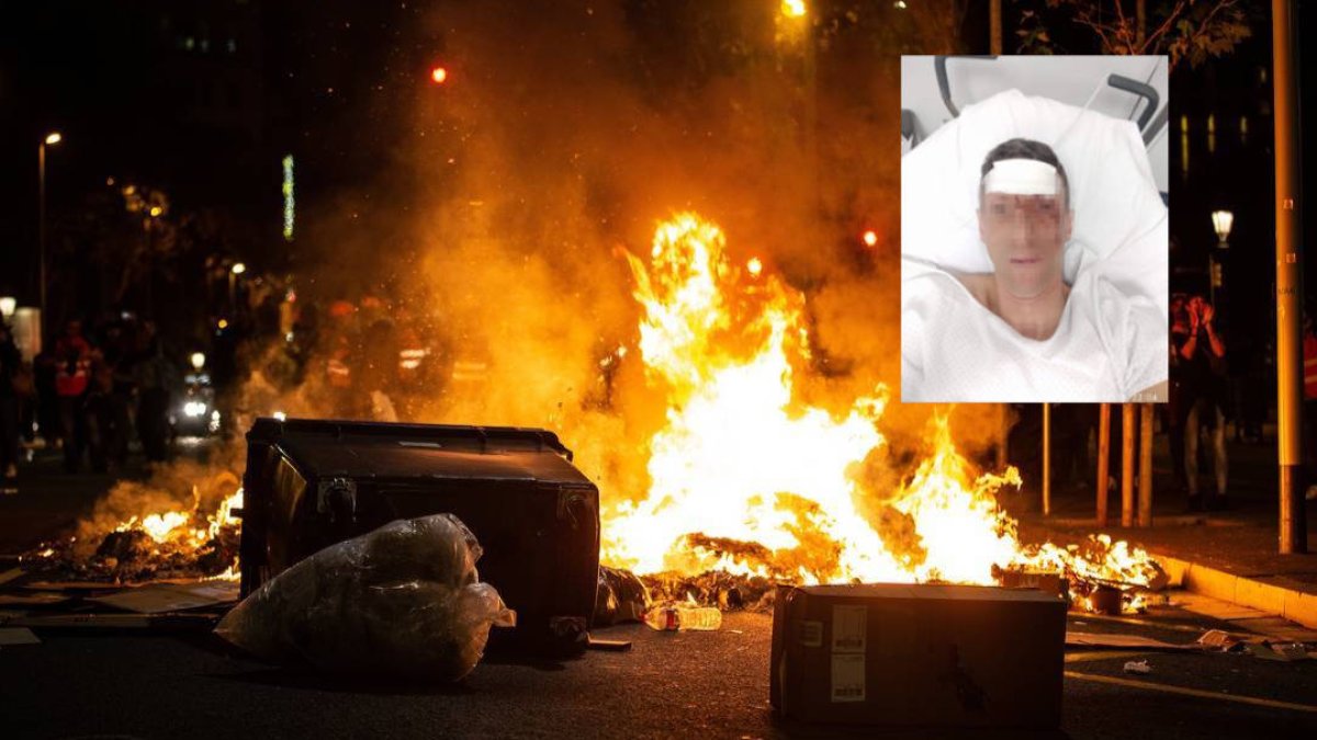 La terrible foto del policía herido que deja a Marlaska en el precipicio