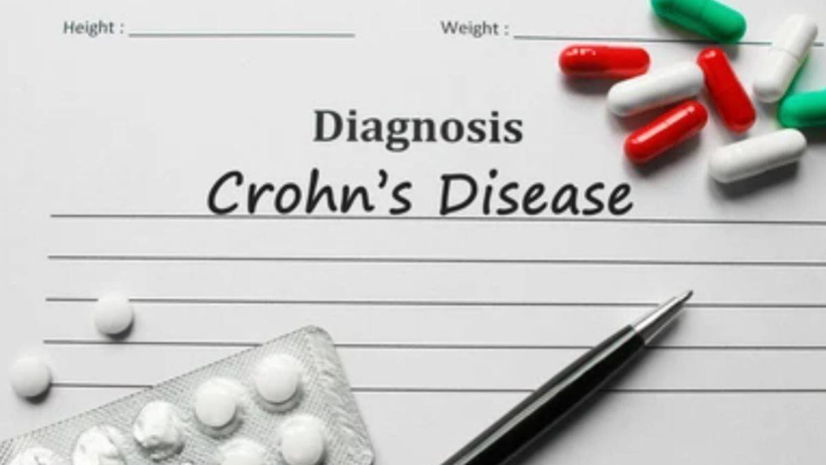 Enfermedad de Crohn