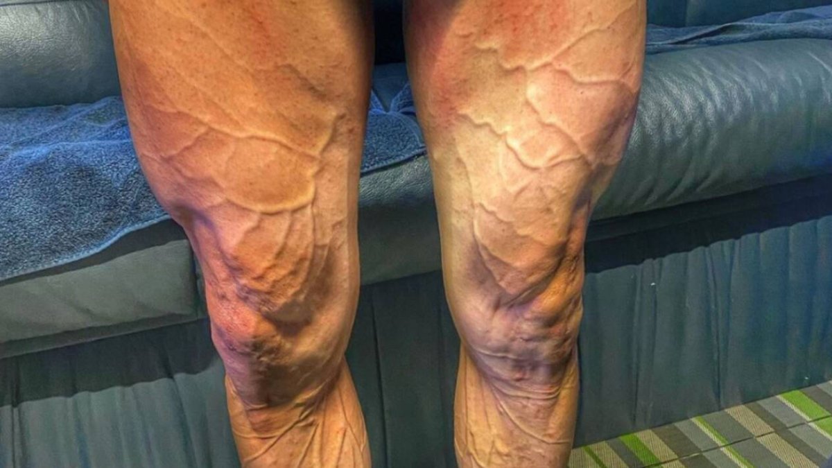 La tremenda fotografía que se ha vuelto viral en la Vuelta a España
