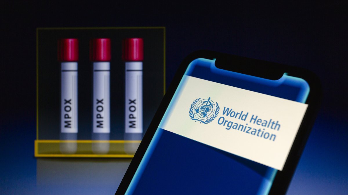 La viruela del mono ya ha sido detectada en Suecia