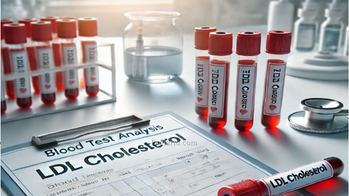 Colesterol malo o LDL
