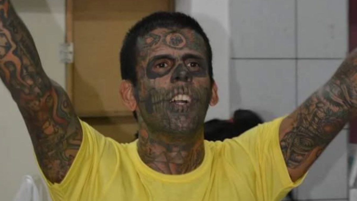 De tener la cara llena de tatuajes...a quitarse toda la tinta: así le ha quedado el rostro