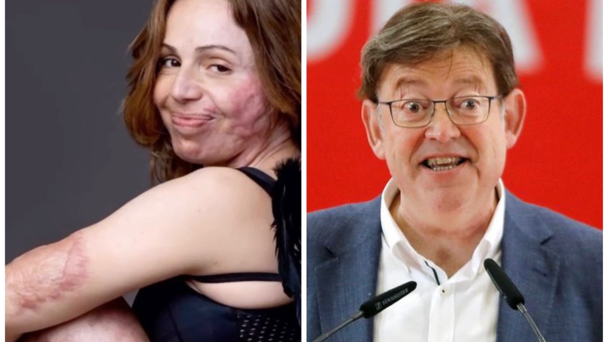 Una víctima quemada destroza la gestión del PSOE en los incendios con recado letal a Ximo Puig