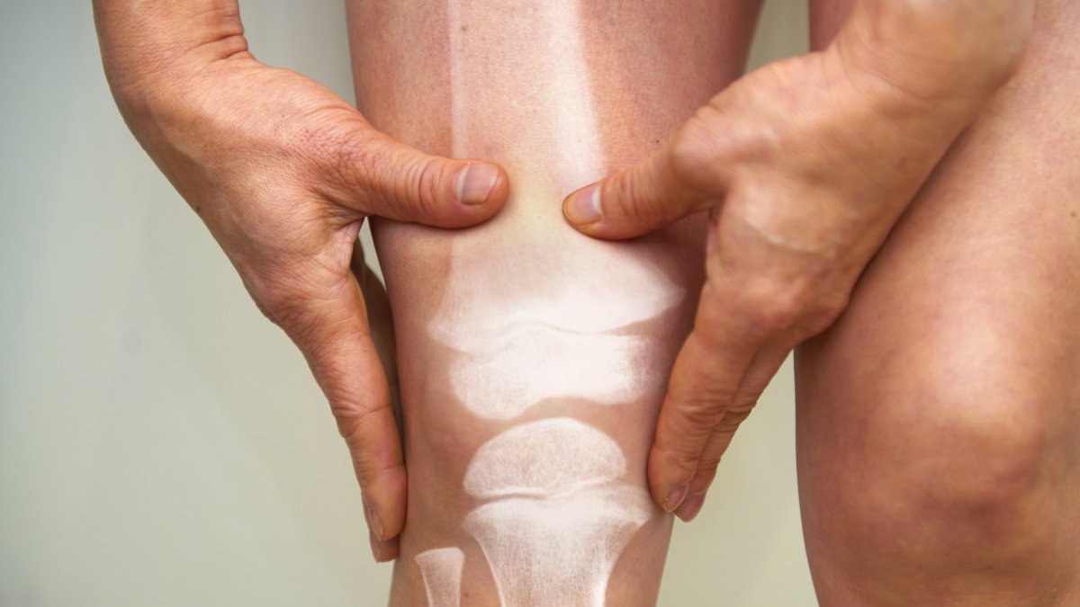 Un fármaco experimental activa un “botón biológico” y promete revertir la osteoporosis