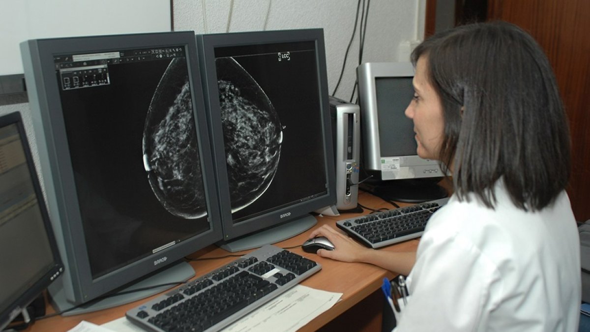 El SAS asegura no haber recibido quejas directas por fallos en el cribado del cáncer de mama y busca una solución urgente