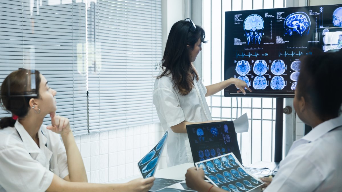 Equipo médico valorando unas pruebas con IA