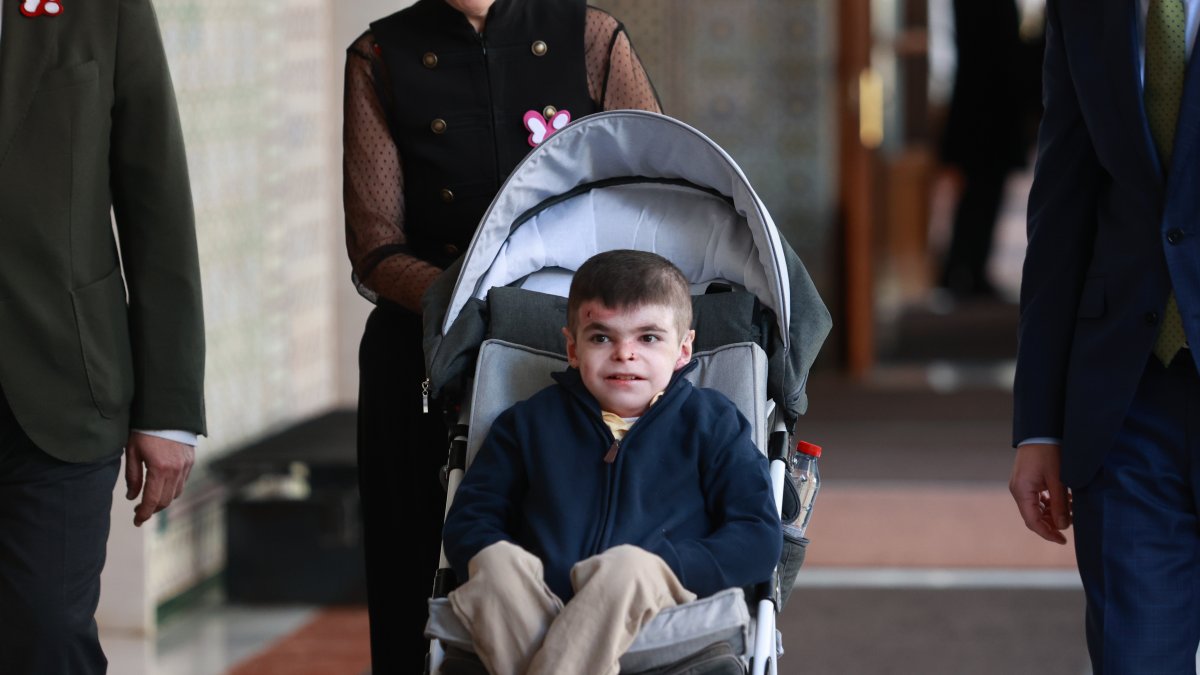 Leo García, el joven sevillano de 12 años, afectado por la enfermedadad conocida como piel de mariposa