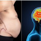 Obesidad-cerebro