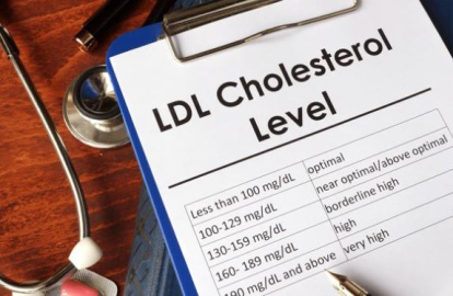 Colesterol malo o LDL