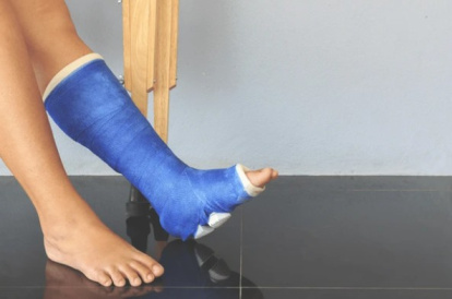 Fractura tobillo