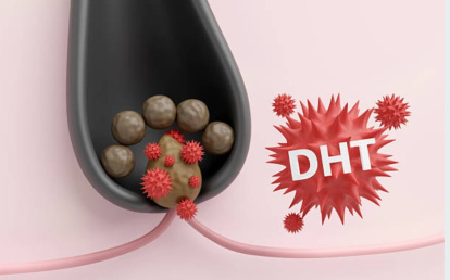 DHT (Dihidrotestosterona)
