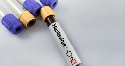 Hantavirus