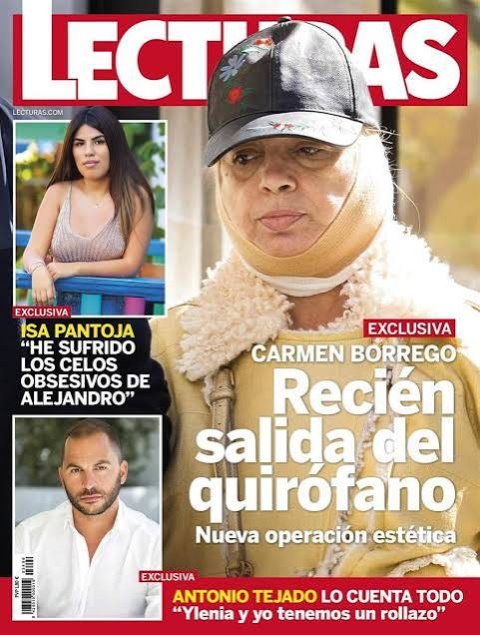 Carmen Borrego a toda portada cuando se sometió a una operación para reducir la papada.